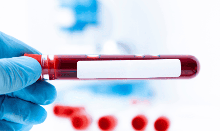 The Essential Blood Tests for CrossFit Athletes: A Dietitian’s Guide to Improving Your Health and Performance